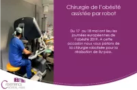 CHIRURGIE DE L’OBESITE ASSISTEE PAR ROBOT